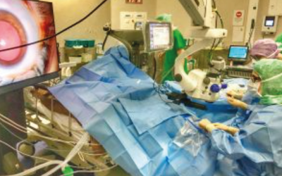 Chirurgie de la rétine en 3D par le Centre Rétine Montpellier