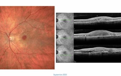 Une histoire de bulle